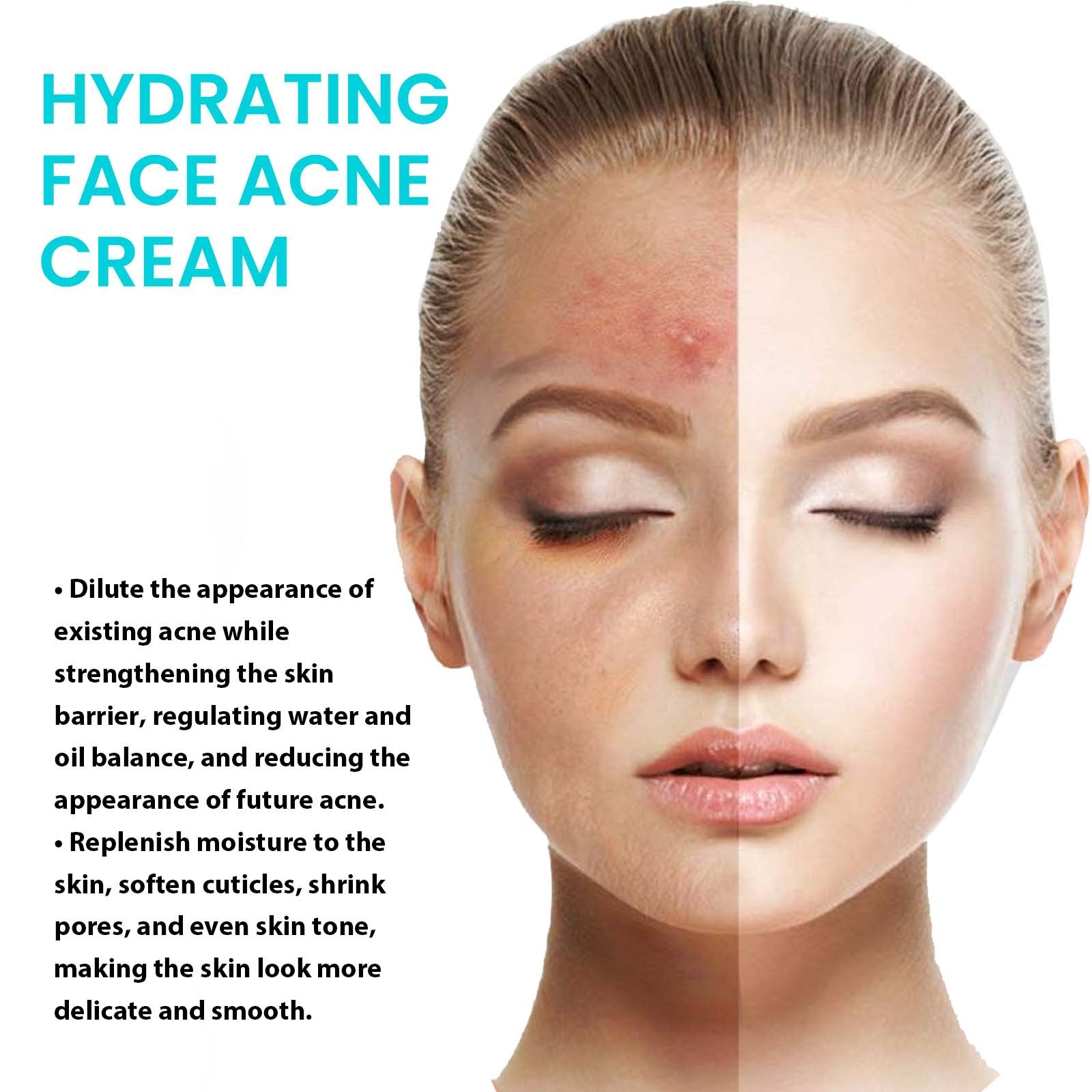 STORAZONE Makeup 25g Desalting Pimple Moisturizing Delicate Skin Lightening Cream