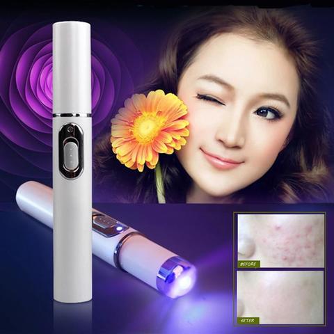 STORAZONE Makeup Blue Light Therapy Acne Laser Pen Soft Scar Wrinkle Removal Treatment Device Skin Care Beauty Equipment