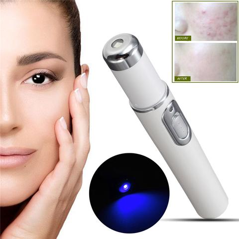 STORAZONE Makeup Blue Light Therapy Acne Laser Pen Soft Scar Wrinkle Removal Treatment Device Skin Care Beauty Equipment